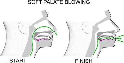 Soft palate blowing